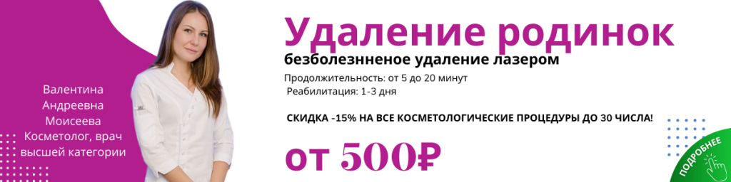 Удаление родинки лазером Удаление родинки лазером