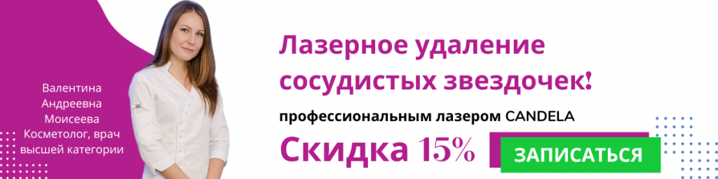 Скидка 15% на лазерное удаление сосудистых звездочек!.png